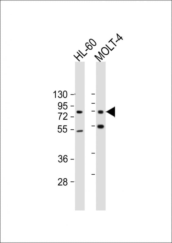 CBFA2T3 Antibody (clone 1719CT425.37.65)