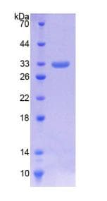 Human LDHA / LDH1 Protein (Recombinant His-T7)
