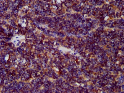 CDCA7L Antibody