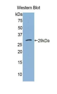 PH / PAH Antibody (aa228-452)