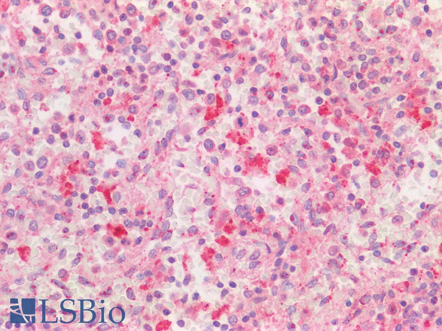PPT1 / CLN1 Antibody (C-Terminus)