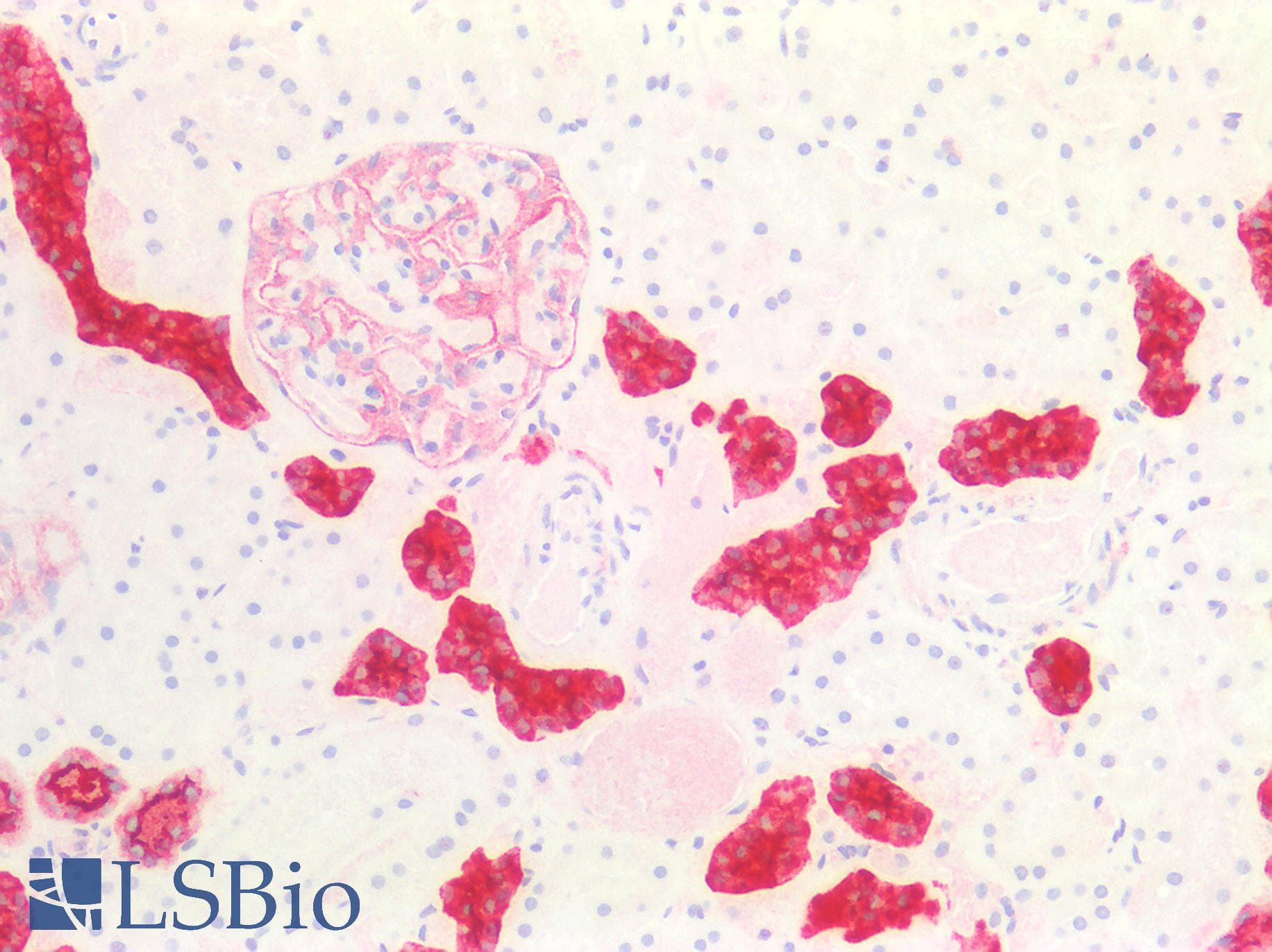 PathPlus™ EMA / MUC1 Antibody (clone B24.1)