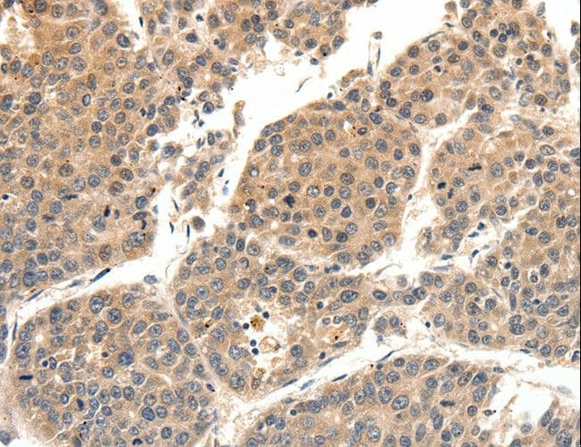 SLC27A1 / FATP Antibody