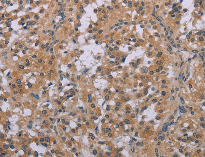ACVR2 / ACVR2A Antibody