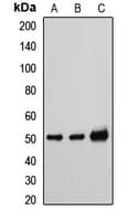 Tyrosine Aminotransferase Antibody