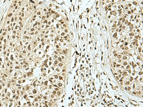 Polyclonal Rabbit anti-Human KHSRP / FBP2 Antibody (IHC)