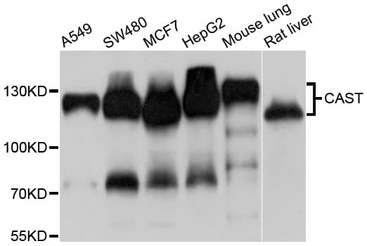 IHC-plus™ CAST / Calpastatin Antibody
