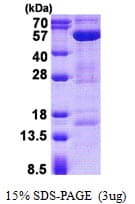 Human STAMBP / AMSH Protein (Recombinant His)
