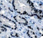 AR / Androgen Receptor Antibody