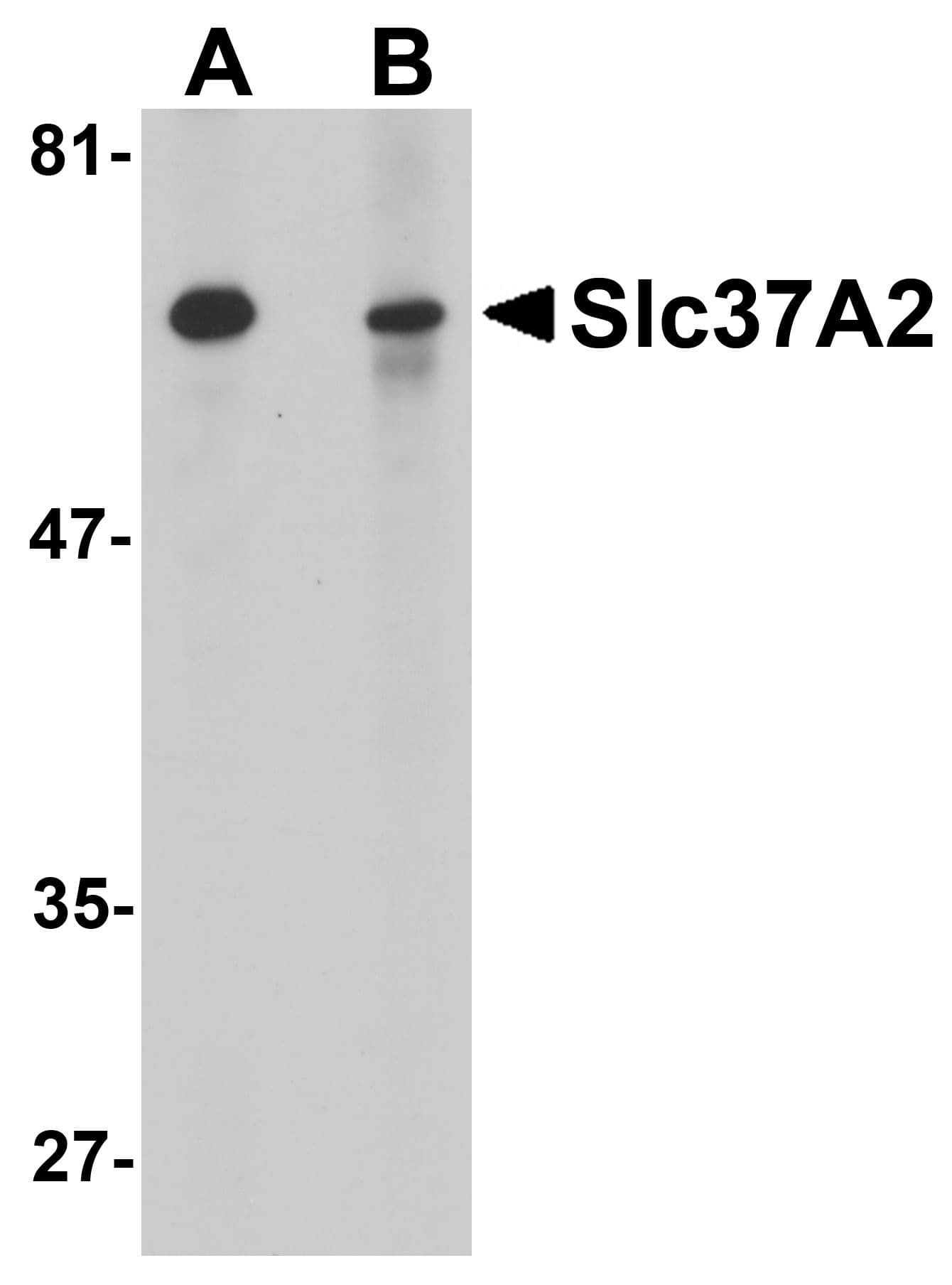 IHC-plus™ SLC37A2 Antibody