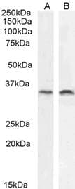 LGALS8 / Galectin 8 Antibody
