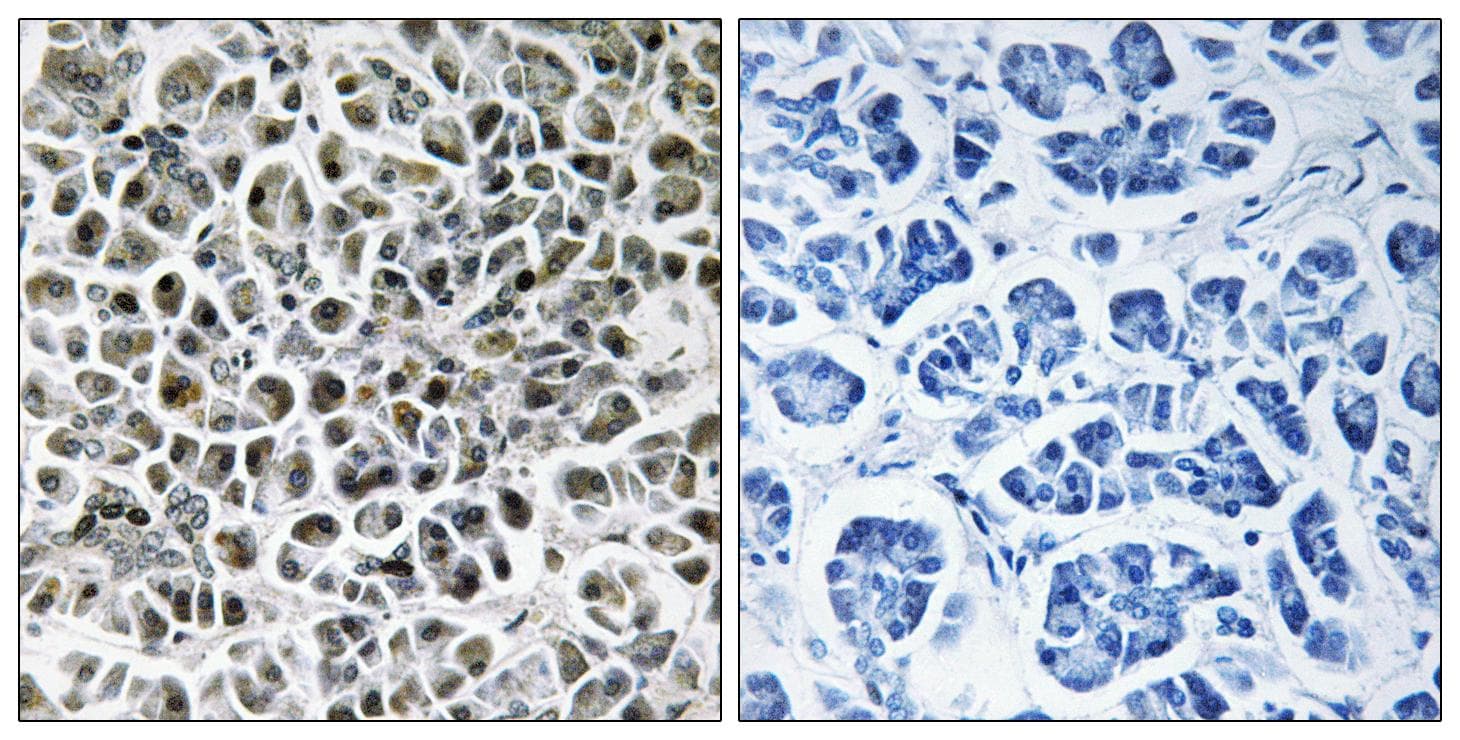 NDUFA3 / B9 Antibody