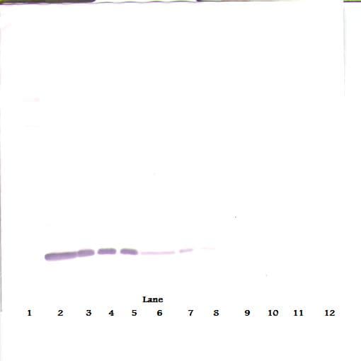 CSF2 / GM-CSF Antibody (Biotin)
