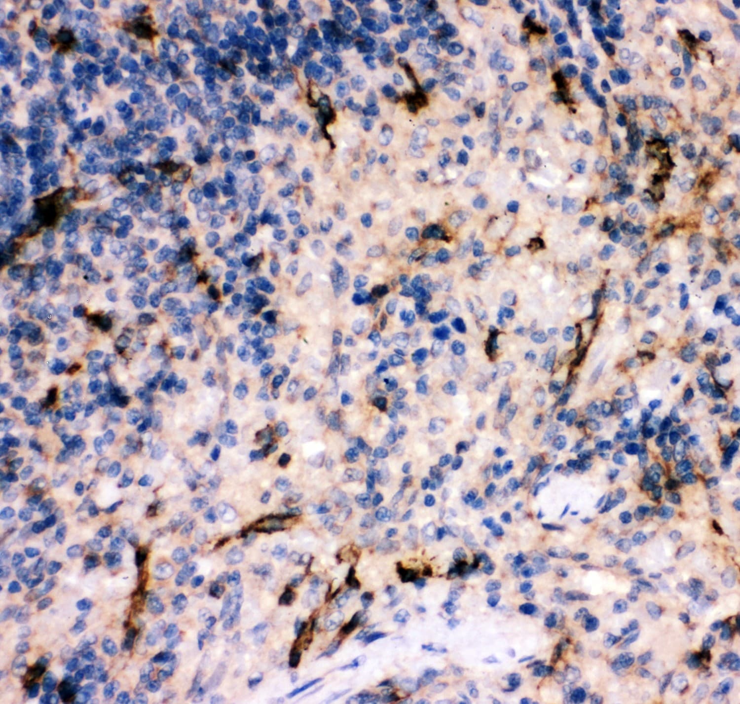 Polyclonal Rabbit anti-Rat Complement C5 Antibody (aa1-77, IHC, WB)