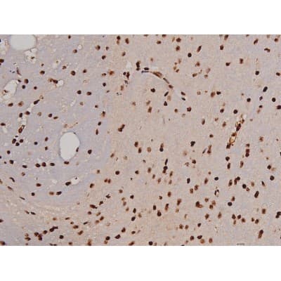 FAK / Focal Adhesion Kinase Antibody (phospho-Tyr397)