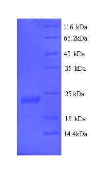 Human VEGFB Protein (Recombinant 6His, N-terminus)