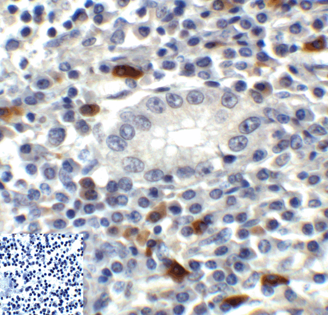 IHC-plus™ TIGIT Antibody (clone 3B5)