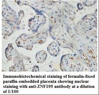 Polyclonal Rabbit anti-Human ZNF195 Antibody (aa379-597, IHC, WB)
