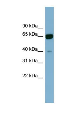 ZNF169 Antibody (aa71-120)