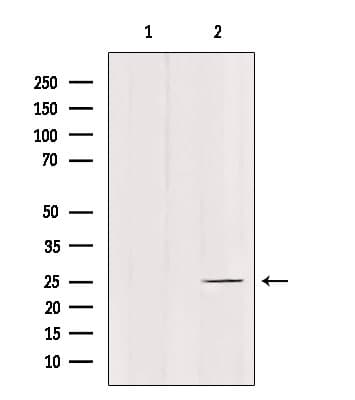 Polyclonal Rabbit anti-Human C1QL4 Antibody (IHC, WB)