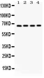 OPTN / Optineurin Antibody (aa241-577)