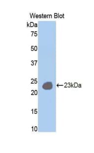IL12RB1 / CD212 Antibody (aa429-603)