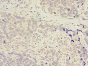 ADA / Adenosine Deaminase Antibody (aa157-343)