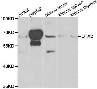 Polyclonal Rabbit anti-Human DTX2 Antibody (IHC, WB)