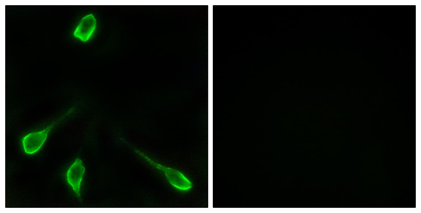 OR52E4 Antibody (aa200-249)