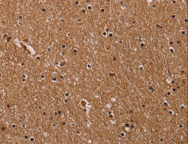Polyclonal Rabbit anti-Human FABP3 / H-FABP Antibody (IHC)