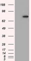 IHC-plus™ H6PD / G6PDH Antibody (clone 1H6)