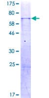 Human WNT14 / WNT9A Protein (Recombinant GST)
