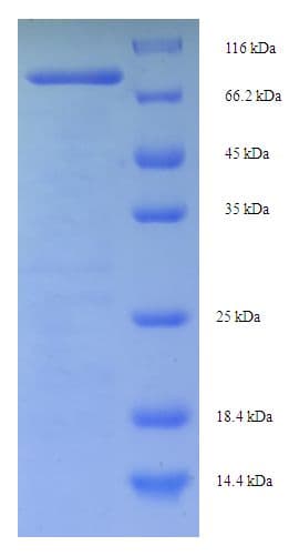 Human CEP63 Protein (Recombinant His-SUMO)