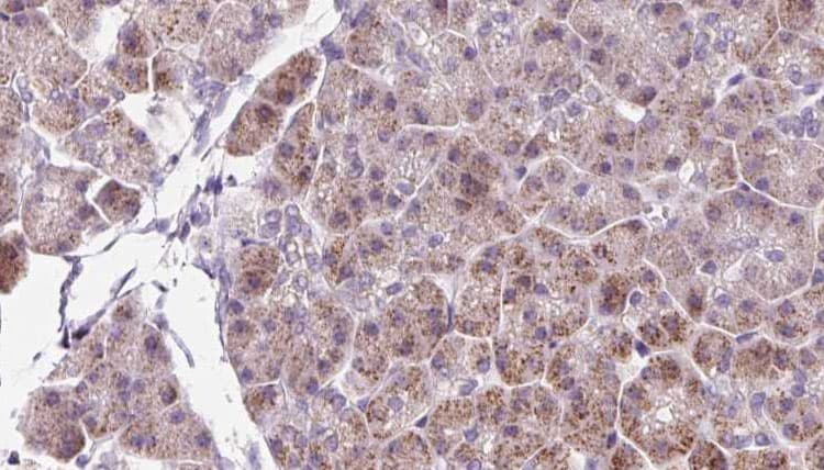 DBN1 / Drebrin Antibody