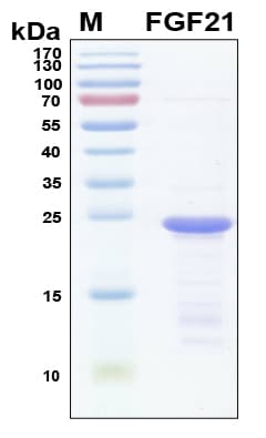 Human FGF21 Protein (Recombinant 6His, N-terminus)