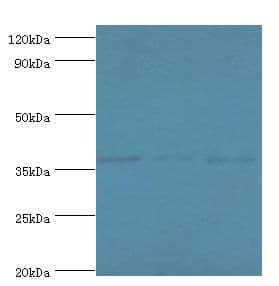 BM022 / MRPL1 Antibody (aa51-324)