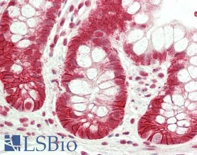 IHC-plus™ RREB1 Antibody (530-610 aa, Internal)