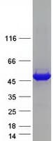 Human OAT Protein (Recombinant Myc-DDK (Flag))