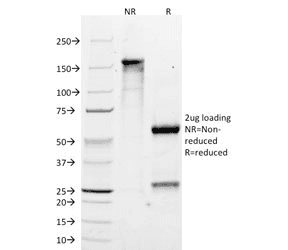 CYP2E1 Antibody (clone M12P4H2)