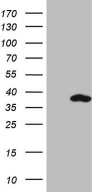 SNRPB2 Antibody (clone OTI2A5, Carrier-free)