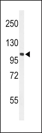 EPHA2 / EPH Receptor A2 Antibody (aa30-60)