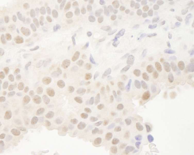 BHLHB2 / DEC1 Antibody (aa350-C-term)