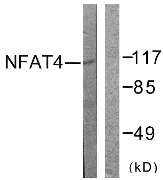 Polyclonal Rabbit anti-Human NFAT4 / NFATC3 Antibody (aa131-180, WB)