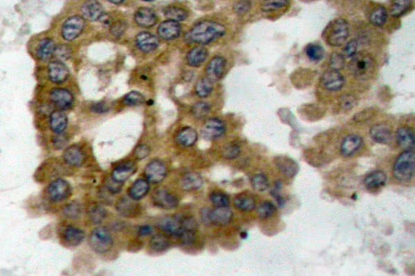 Polyclonal Rabbit anti-Human AKT2 Antibody (phospho-Ser474, IHC, WB)