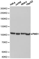 Polyclonal Rabbit anti-Human HPMS1 / PMS1 Antibody (IHC, WB)