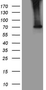 ACS5 / ACSL5 Antibody (aa104-620, clone OTI1D4)