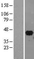 PITX2 / RGS Protein (Over-Expression Lysate Myc-DDK (Flag))