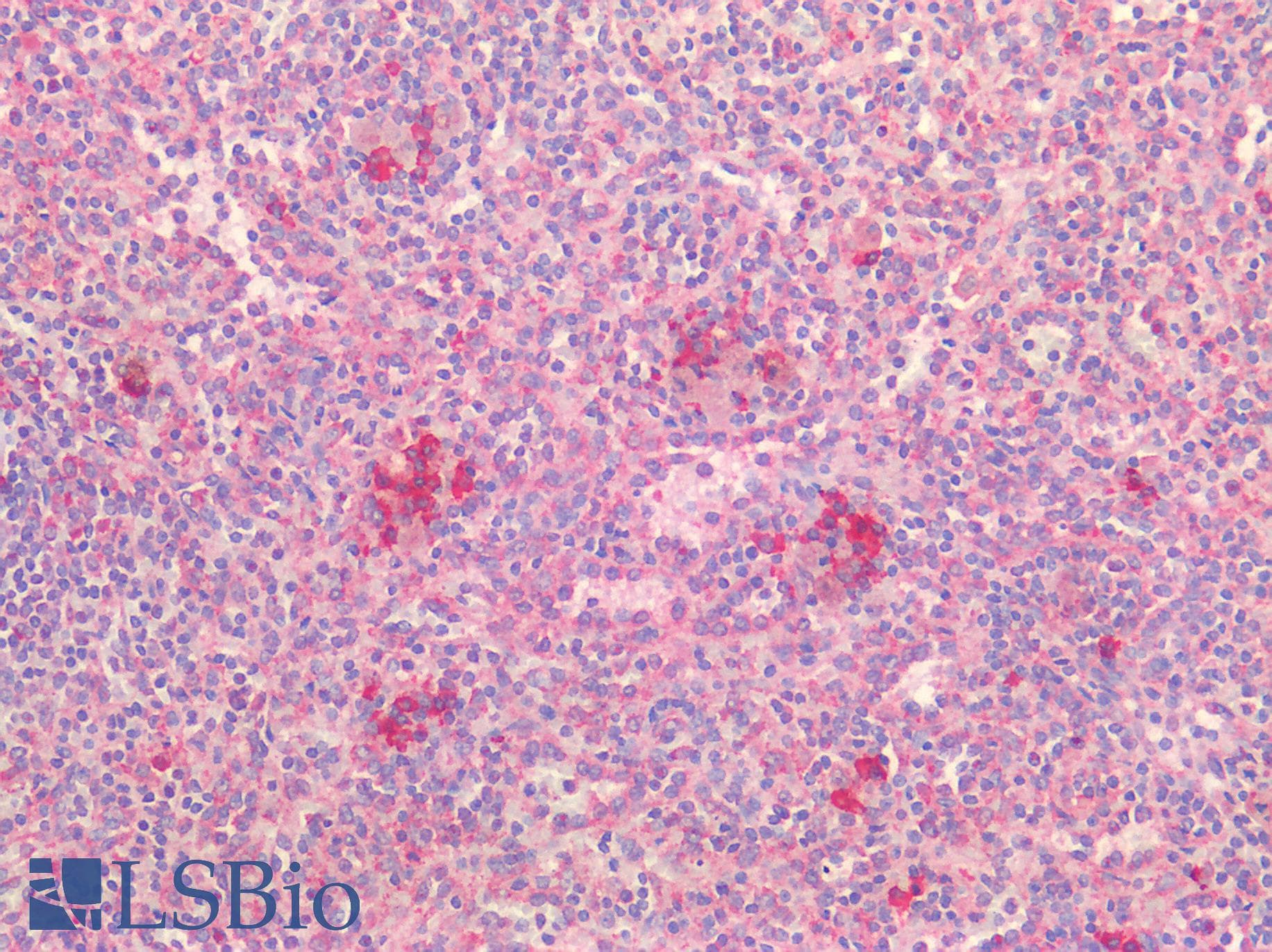 IHC-plus™ Polyclonal Rabbit anti-Human PDGFRA / PDGFR Alpha Antibody (IHC)