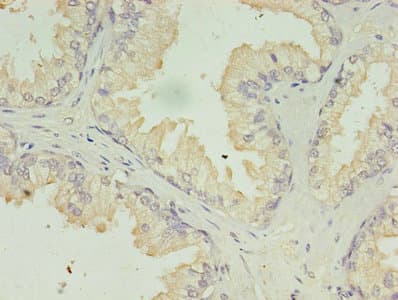 ACAA1 Antibody (aa27-331)