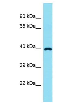 FADS6 Antibody (aa213-262)